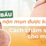 Bà bầu nặn mụn được không? Cách chăm sóc da mụn cho mẹ bầu