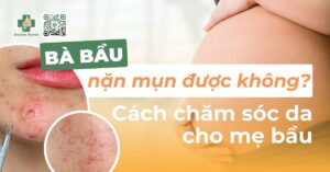 bà bầu nặn mụn được không