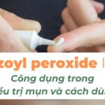 Benzoyl peroxide là gì? Công dụng trong điều trị mụn và cách dùng
