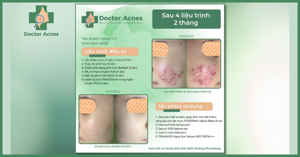 ca lâm sàng có dùng derma forte