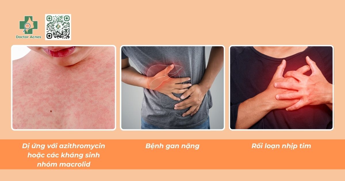 chống chỉ định và thận trọng khi sử dụng azithromycin