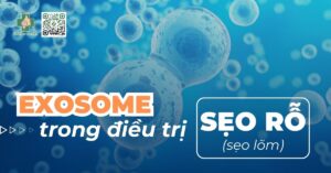 exosome điều trị sẹo rỗ