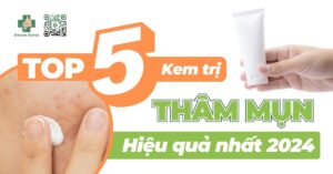 Top 5 kem trị thâm mụn hiệu quả nhất