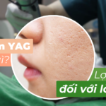 Laser Erbium YAG là gì? Lợi ích đối với làn da