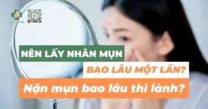 Nên lấy nhân mụn bao lâu một lần? Nặn mụn bao lâu thì lành?