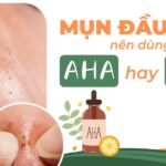 Mụn đầu đen nên dùng AHA hay BHA?