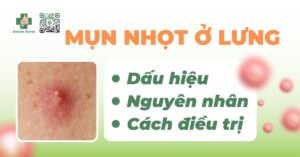 mụn nhọt ở lưng