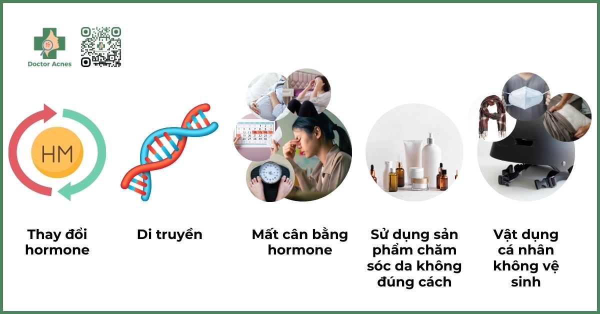 nguyên nhân gây mụn bọc ở mũi