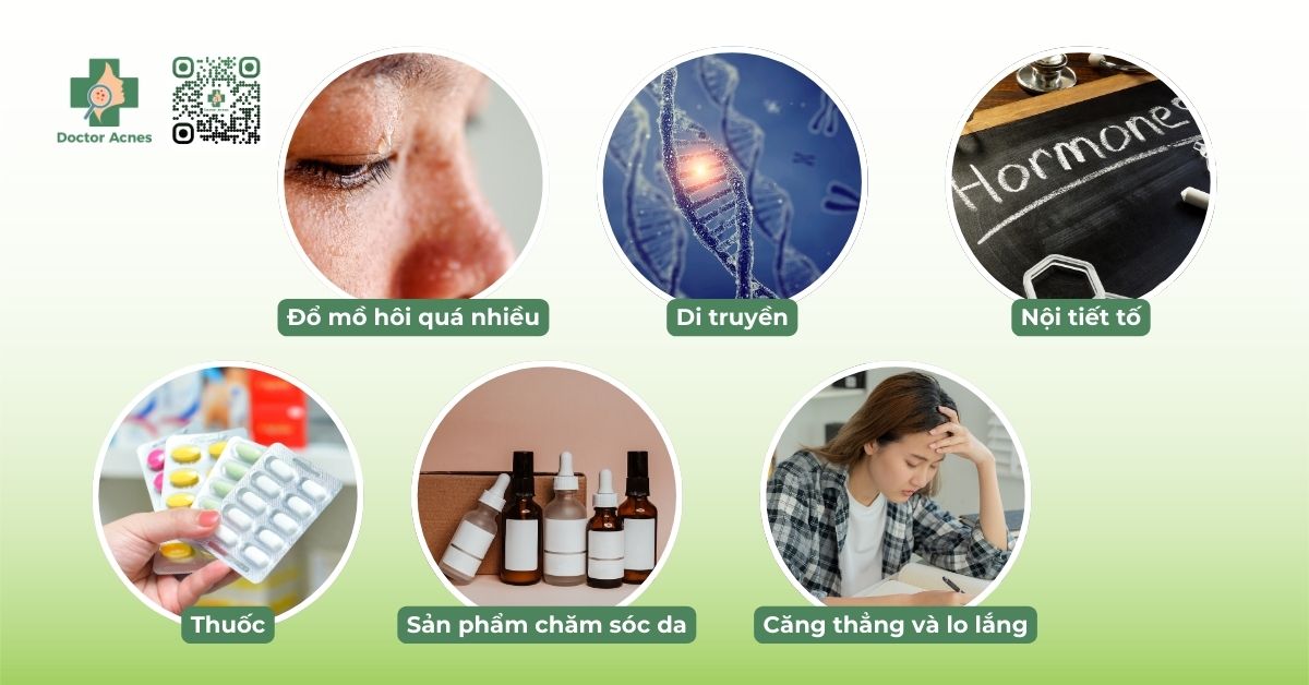 những nguyên nhân gây ra mụn chai