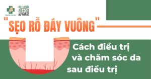 Sẹo rỗ đáy vuông