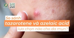 so sánh tazarotene và azelaic acid