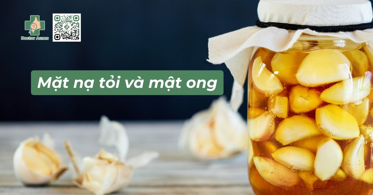 Trị mụn bằng mặt nạ tỏi và mật ong