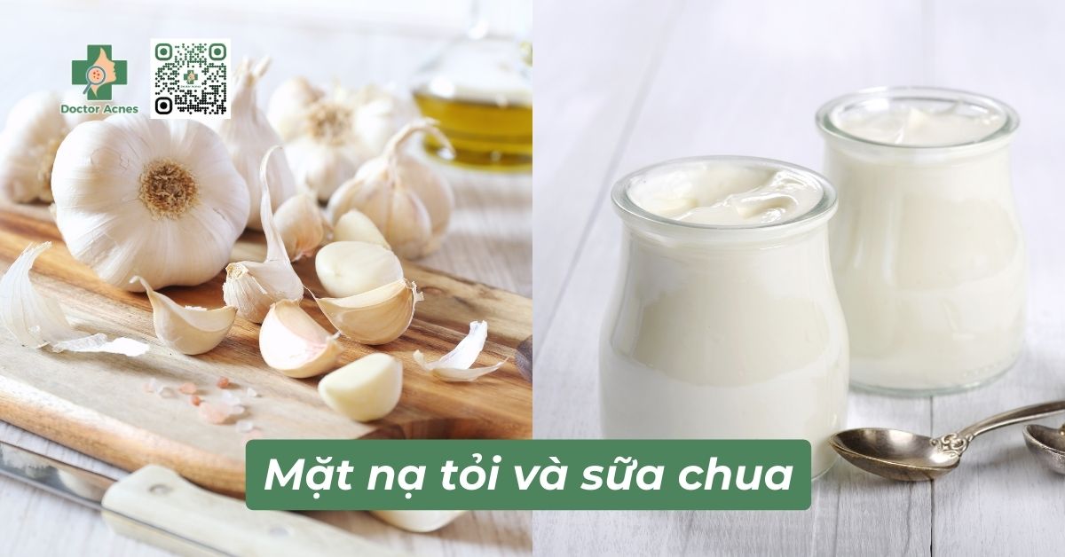 Trị mụn bằng mặt nạ tỏi và sữa chua