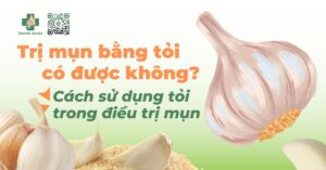 trị mụn bằng tỏi