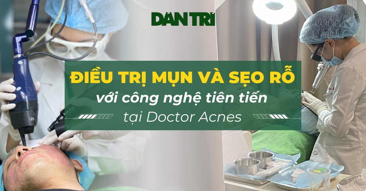 10 - Điều trị mụn và sẹo rỗ với công nghệ tiên tiến tại Doctor Acnes