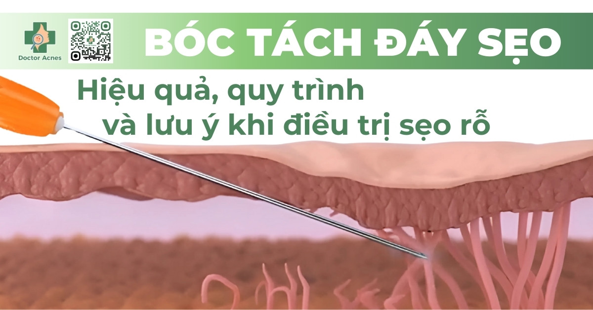 bóc tách đáy sẹo