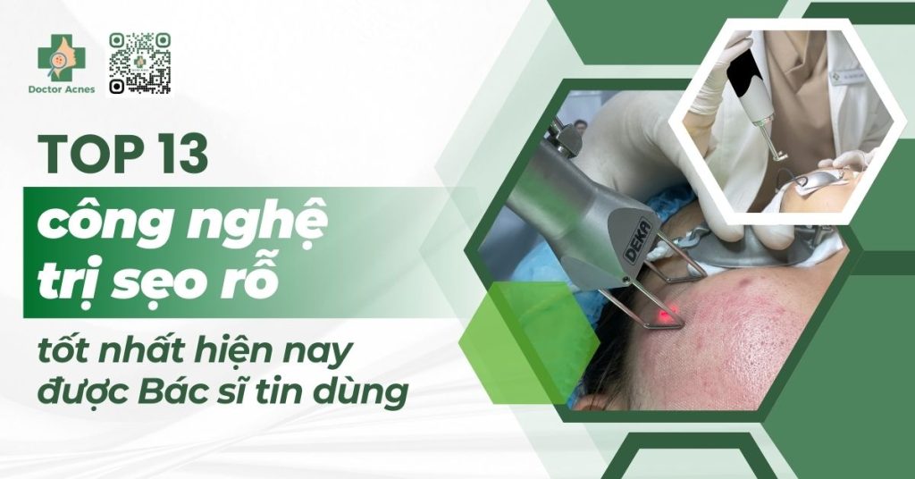 công nghệ trị sẹo rỗ tốt nhất hiện nay