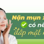 Nặn mụn xong có nên đắp mặt nạ?