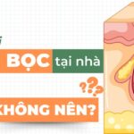 Cách trị mụn bọc tại nhà: nên hay không nên?