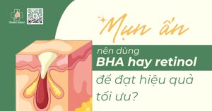 mụn ẩn nên dùng bha hay retinol