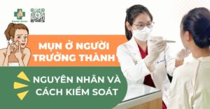 mụn ở người trưởng thành