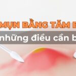 Nặn mụn bằng tăm bông và những điều cần biết