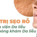 Nên trị sẹo rỗ ở Bệnh viện Da liễu hay Phòng khám Da liễu?