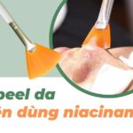 Sau khi peel da có nên dùng niacinamide?