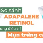 So sánh adapalene và retinol trong điều trị mụn trứng cá
