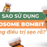 Vì sao sử dụng exosome BOMBIT để điều trị sẹo rỗ?