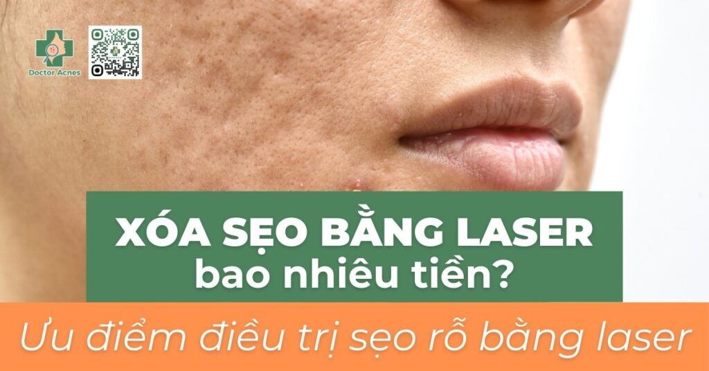 Xóa sẹo bằng laser bao nhiêu tiền