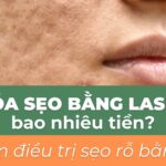 Xóa sẹo bằng laser bao nhiêu tiền? Ưu điểm điều trị sẹo rỗ bằng laser