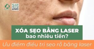 Xóa sẹo bằng laser bao nhiêu tiền