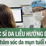 Bác sĩ Da liễu hướng dẫn cách chăm sóc da mụn tuổi dậy thì