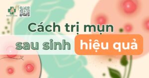 Mẹ bầu bị mụn sinh xong có hết không