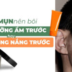 Da mụn nên bôi kem dưỡng ẩm trước hay kem chống nắng trước