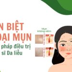 Phân biệt các loại mụn và phương pháp điều trị bởi Bác sĩ Da liễu