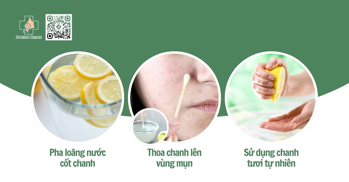 cách trị mụn bằng chanh hiệu quả