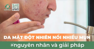 da mặt đột nhiên nổi nhiều mụn