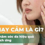 Da nhạy cảm là gì? Bí quyết chăm sóc da hiệu quả và giảm kích ứng