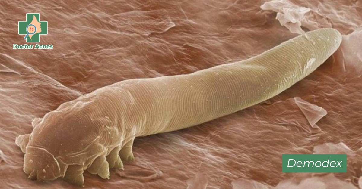 demodex