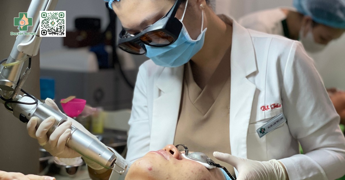 điều trị mụn bằng ánh sáng laser