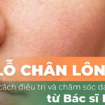 Lỗ chân lông to: cách điều trị và chăm sóc da hiệu quả từ Bác sĩ Da liễu