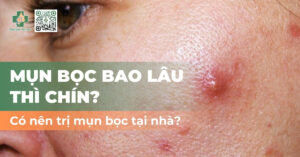 mụn bọc bao lâu thì chín