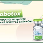 Mesobotox giải pháp mới trong việc giảm nhờn và se khít lỗ chân lông