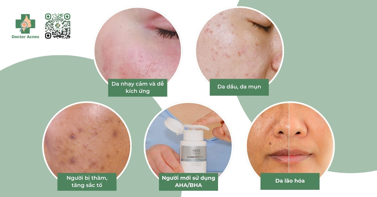 ai phù hợp peel da mandelic acid