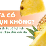Ăn dứa có nổi mụn không? Sự thật về lợi ích của dứa đối với da