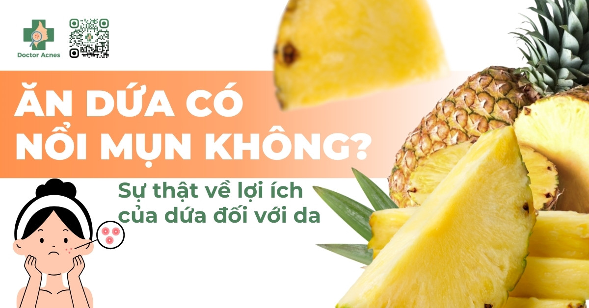 ăn dứa có nổi mụn không