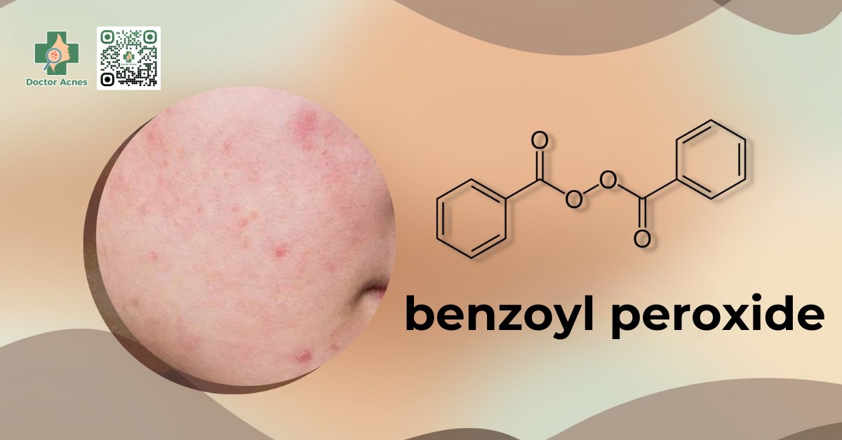 benzoyl peroxide