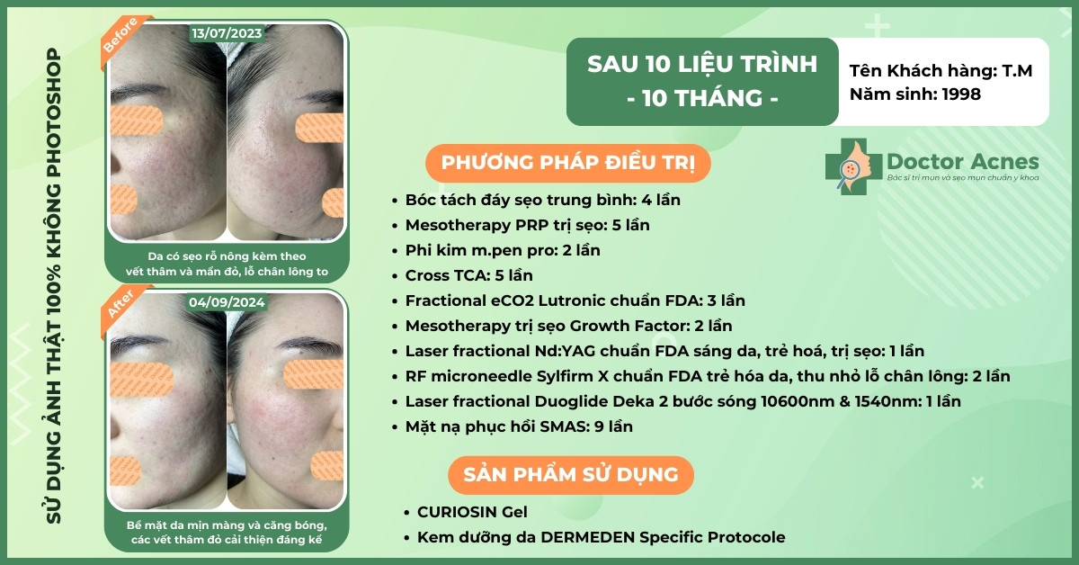 ca lâm sàng trị sẹo